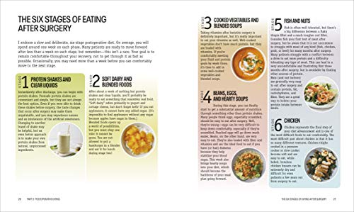 Bariatric Diet Cookbook: Easy Recipes for Success
