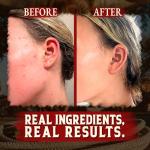 Wrath & Remedy Handmade Whipped Organic Beef Tallow for Skin - 4 OZ (Unscented) — Grass Fed Beef Tallow Moisturizer and Honey Balm for Silky, Sensitive-Skin, Eczema, Rosacea - Free of Harsh Chemicals