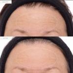 KORA Organics Firming Plant Stem Cell Serum