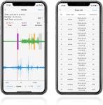 Continuous Sleep Breathing Monitor with Airflow Tracking