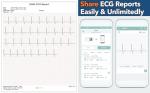 EMAY Portable ECG Monitor | Record ECG and Heart Rate | Compatible with Smartphone and PC