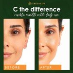 Vitamin C Skin Care Set for Bright Skin