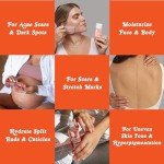 Organic Body Oil for Scars and Stretch Marks