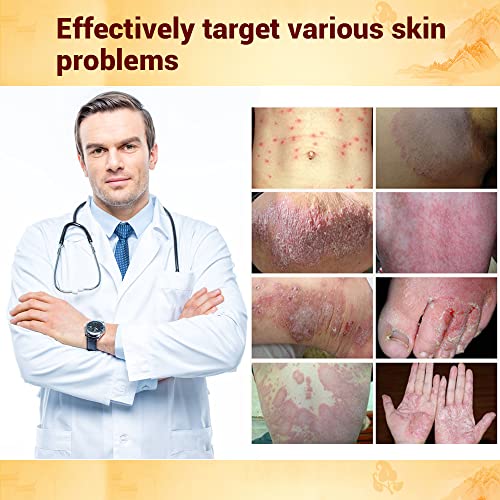 Thousand-Year Herbal Cream for Eczema and Psoriasis