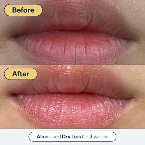 Hydrating Lip Balm for Dry, Cracked Lips