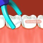 T.Smile Evolutionary Clean Flossers Kit with Handle