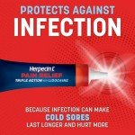 Herpecin-L Cold Sore Treatment with Lidocaine