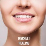 Acculip Cold Sore Patch for Quick Relief