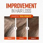 Biotin Shampoo with German Beer Yeast for Hair Growth