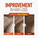 Biotin Shampoo with German Beer Yeast for Hair Growth