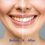 Eco-Friendly Whitening Toothpaste Tablets with Hydroxyapatite