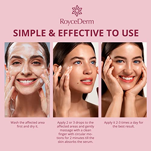 Stye Relief Serum for Fast Eye Treatment