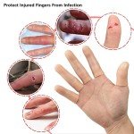 Gel Finger Support Gloves for Eczema Relief (20pcs)