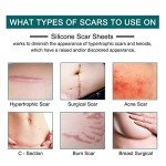 Silicone Scar Tape Roll for Effective Scar Treatment