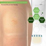 Hydrocolloid Adhesive Bandages for Wound Care, 10 Pack