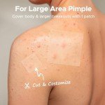 Large Hydrocolloid Acne Patches - 62 Pack