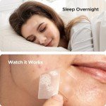 Large Hydrocolloid Acne Patches - 62 Pack