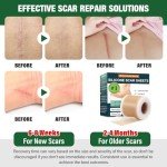 Silicone Scar Sheets and Tape for Surgical Scars