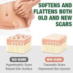 Silicone Scar Sheets and Tape for Surgical Scars