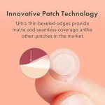 Hydrocolloid Acne Patches for Blemish Treatment