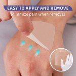 Conkote Hydrocolloid Sterile Wound Dressings Box of 10