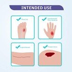 Conkote Hydrocolloid Sterile Wound Dressings Box of 10