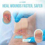 JJ CARE Hydrocolloid Dressing 4x4 - Pack of 10