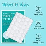180 Hydrocolloid Acne Patches for Blemishes