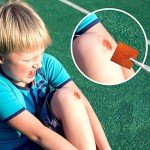 100 Count Antiseptic Prep Solution Pads