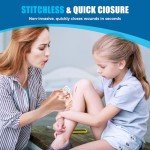 Butterfly Bandages Laceration Repair Kit - 4 Pcs