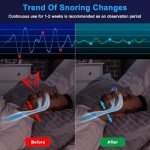Adjustable Anti-Snoring Device for Men and Women