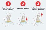 LifeVac Choking Rescue Device Home and Travel Kit
