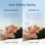 Difiney Advanced Anti Snoring Device 4.0: Anti Snoring Mouthpiece Device Mouth Guard - Effective Anti Snore Solution for Men and Women - Customizable Adjustable Comfortable - Patent Pending Design