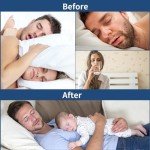 Gentle Latex-Free Medical Tape - 120 PCS