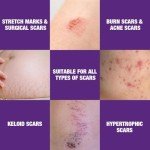 Scar Cream and Gel for Surgical Scars