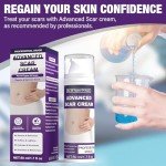 Scar Cream and Gel for Surgical Scars