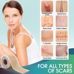 Silicone Scar Sheets for Effective Scar Removal