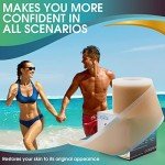 Silicone Scar Sheets for Effective Scar Removal