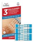 Clozex Laceration Closures - No Stitches Needed