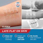 Clozex Laceration Closures - No Stitches Needed