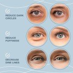 24k Gold Under Eye Patches for Puffiness