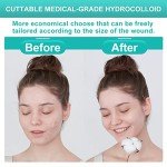 Dimora Hydrocolloid Wound Dressings - 20 Pack, 4"x4