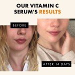 Vitamin C Face Serum for Dark Spots and Brightening