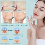 Pumkot Advanced Silicone Scar Removal Cream 1.7 oz