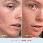 Ultra Repair Cream - Intense Hydration, 2 Pack