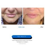 Cupping Warehouse Classic 4-Piece Silicone Facial Set