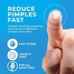 Hydrocolloid Pimple Patches for Acne Relief (120)