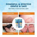 Hermon Antifungal Cream for Ringworm and Skin Issues