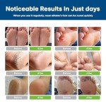 Antifungal Cream for Foot and Body Relief 30g