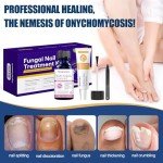 Extra Strength Toenail Fungus Antifungal Cream